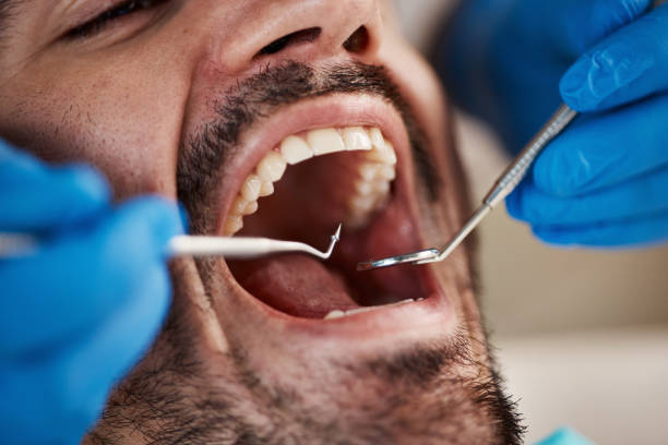 Best Knocked-Out Tooth Emergency  in Roseland, FL